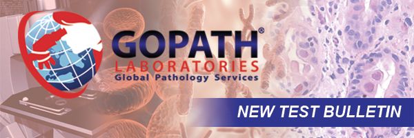 New Test Release: Liquid Bx for EGFR Lung Cancer
